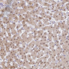 Immunohistochemical staining of human liver shows moderate nuclear and cytoplasmic positivity in hepatocytes.