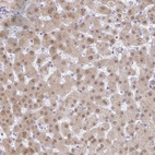 Immunohistochemical staining of human liver shows moderate nuclear and cytoplasmic positivity in hepatocytes.