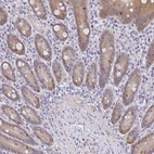 Immunohistochemical staining of human duodenum shows moderate nuclear/ cytoplasmic positivity in enteroendocrine cells.