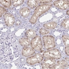 Immunohistochemical staining of human kidney shows moderate nuclear/ cytoplasmic positivity in cells in tubules.
