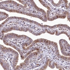 Immunohistochemical staining of human Fallopian tube shows moderate granular cytoplasmic positivity in glandular cells.