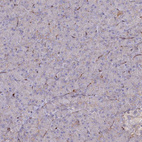 Immunohistochemical staining of human Pancreas shows low expression in exocrine glandular cells as expected.