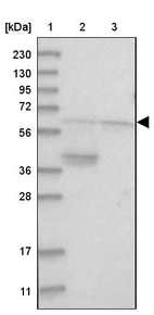 Lane 1: Marker [kDa] 230, 130, 95, 72, 56, 36, 28, 17, 11_br/_Lane 2: Human cell line RT-4_br/_Lane 3: Human cell line U-251MG sp