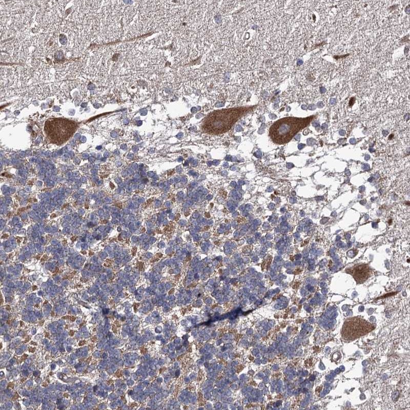 Anti-DYDC1 Antibody