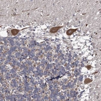 Anti-DYDC1 Antibody