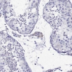 Immunohistochemical staining of human testis shows weak cytoplasmic positivity in Leydig cells.