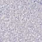 Immunohistochemical staining of human liver shows no positivity in hepatocytes as expected.