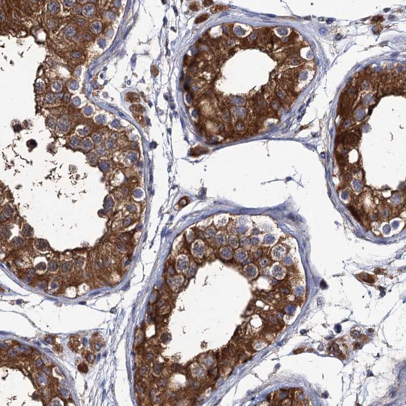 Anti-DYDC1 Antibody