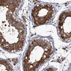 Anti-DYDC1 Antibody