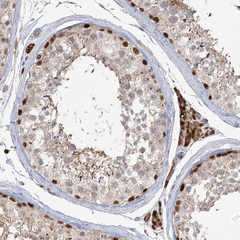 Anti-KBTBD4 Antibody