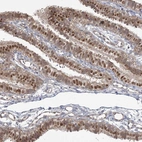 Immunohistochemical staining of human fallopian tube shows moderate nuclear and additional cytoplasmic positivity in glandular cells.