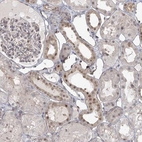 Immunohistochemical staining of human kidney shows moderate nuclear and additional positivity in cells in tubules.
