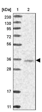 Lane 1: Marker [kDa] 230, 130, 95, 72, 56, 36, 28, 17, 11_br/_Lane 2: Human cell line RT-4