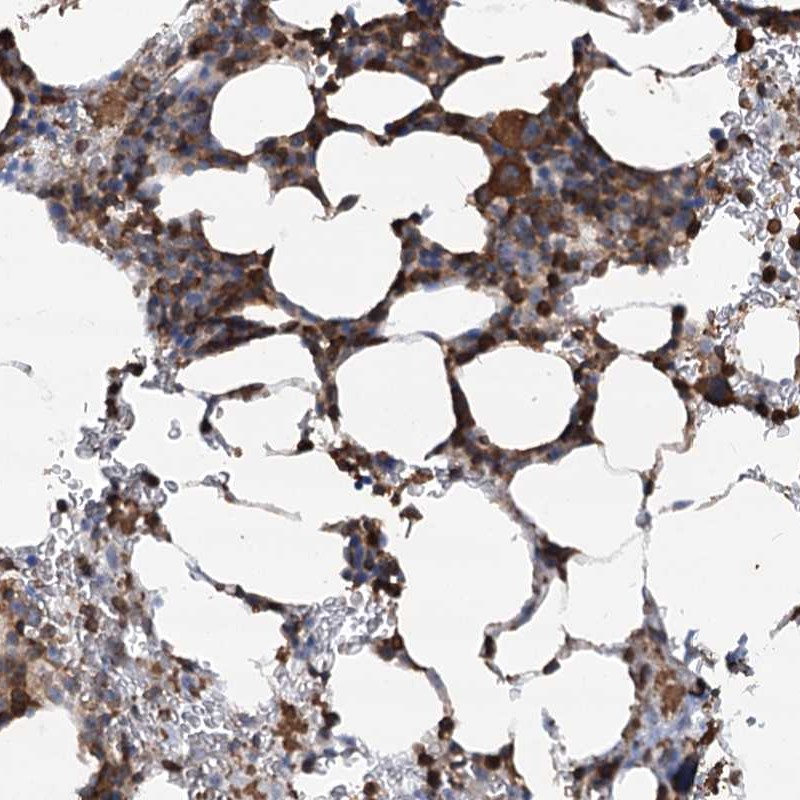 Anti-WDR36 Antibody