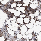 Anti-WDR36 Antibody