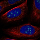 Immunofluorescent staining of human cell line U-2 OS shows localization to nucleoli.