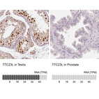 Anti-TTC23L Antibody