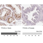 Anti-TTC23L Antibody