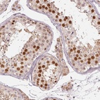 Immunohistochemical staining of human testis shows high expression.