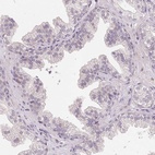 Immunohistochemical staining of human prostate shows low expression as expected.