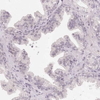 Immunohistochemical staining of human prostate shows low expression as expected.