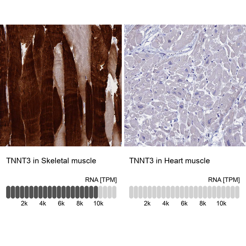 Anti-TNNT3 Antibody