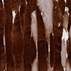 Immunohistochemical staining of human skeletal muscle shows strong cytoplasmic positivity in myocytes.