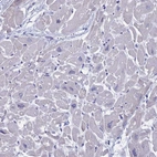 Immunohistochemical staining of human heart muscle shows no cytoplasmic positivity in cardiomyocytes as expected.