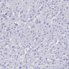Anti-TNNT3 Antibody