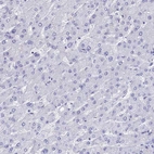 Immunohistochemical staining of human liver shows no positivity in hepatocytes as expected.