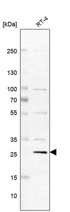 Western blot analysis in human cell line RT-4.