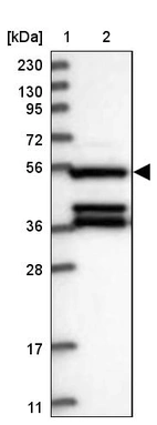 Lane 1: Marker [kDa] 230, 130, 95, 72, 56, 36, 28, 17, 11_br/_Lane 2: Human cell line RT-4
