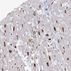 Anti-VWA5A Antibody