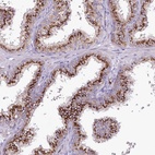 Anti-VWA5A Antibody