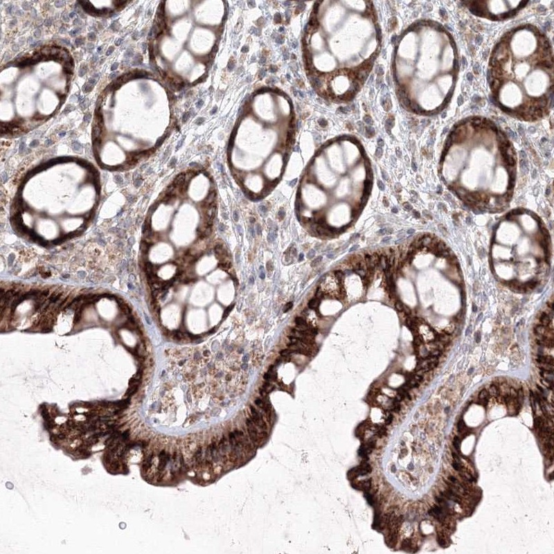 Anti-ANAPC16 Antibody