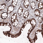 Anti-ANAPC16 Antibody