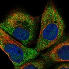 Immunofluorescent staining of human cell line A-431 shows localization to cytosol.