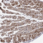 Immunohistochemical staining of human heart muscle shows moderate cytoplasmic positivity in cardiomyocytes.