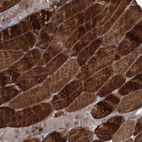 Immunohistochemical staining of human skeletal muscle shows strong cytoplasmic positivity in myocytes.