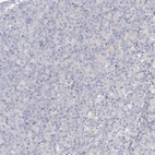 Immunohistochemical staining of human lymph node shows no positivity in germinal center cells as expected.