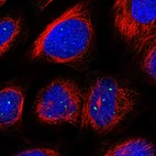 Immunofluorescent staining of human cell line U-2 OS shows localization to nuclear bodies.