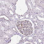 Immunohistochemical staining of human kidney shows moderate cytoplasmic positivity in cells in glomeruli.