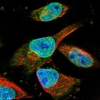 Anti-ZNF487 Antibody