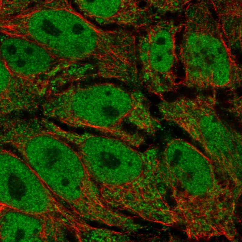 Anti-AKR1E2 Antibody
