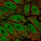 Anti-AKR1E2 Antibody
