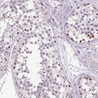 Immunohistochemical staining of human testis shows high expression.