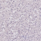 Immunohistochemical staining of human liver shows low expression as expected.