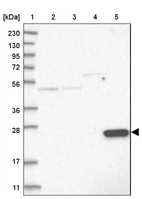 Lane 1: Marker [kDa] 230, 130, 95, 72, 56, 36, 28, 17, 11_br/_Lane 2: Human cell line RT-4_br/_Lane 3: Human cell line U-251MG sp_br/_Lane 4: Human plasma (IgG/HSA depleted)_br/_Lane 5: Human liver tissue