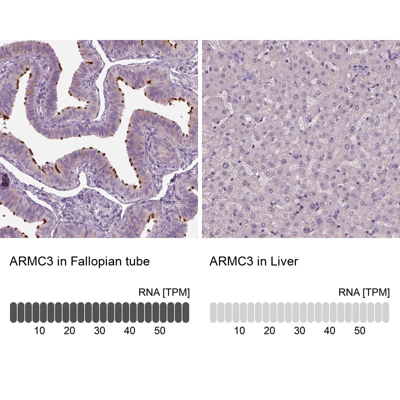 Anti-ARMC3 Antibody