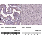 Anti-ARMC3 Antibody